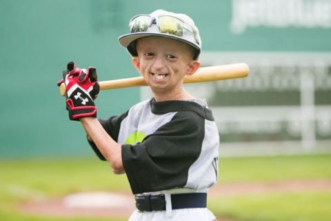 Viera, featured in E:60, dies at 14 of rare disease